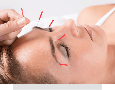 Facial rejuvenation