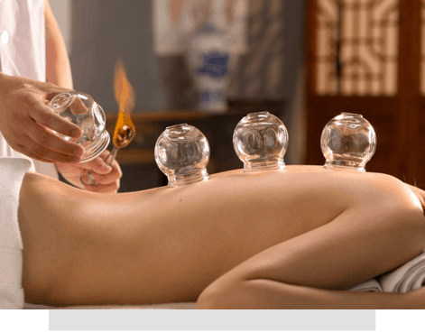 Cupping